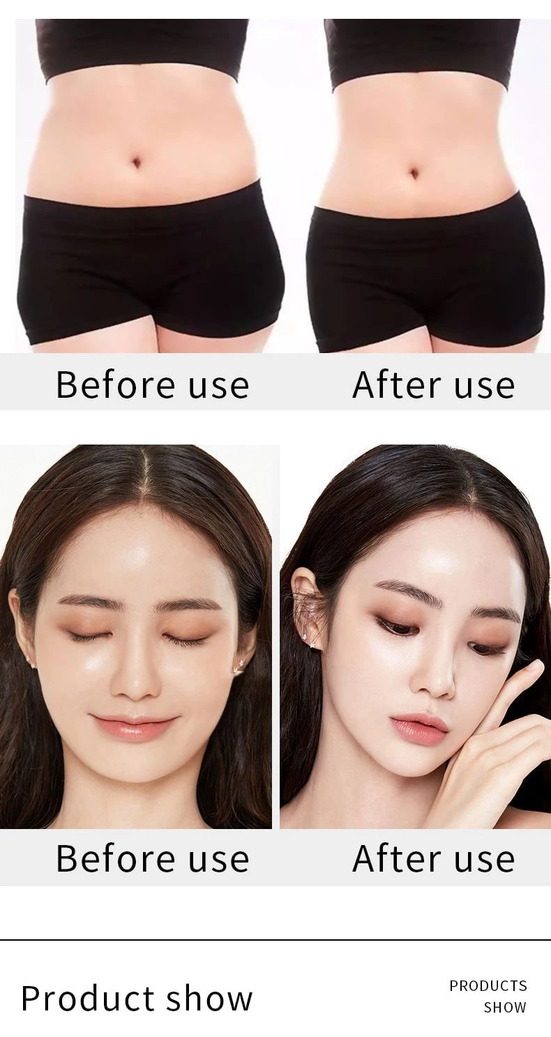 Körperschlankheitsmaschine Lipo Fett