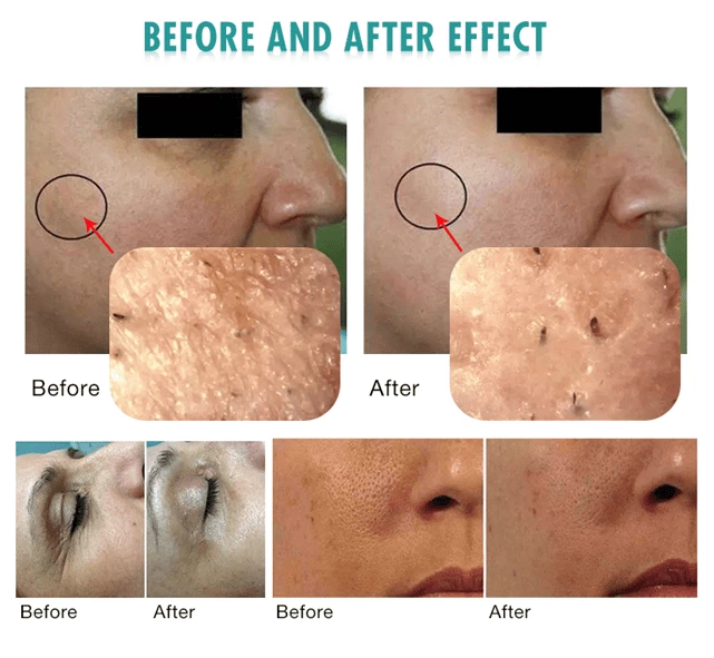 professional face massage machine