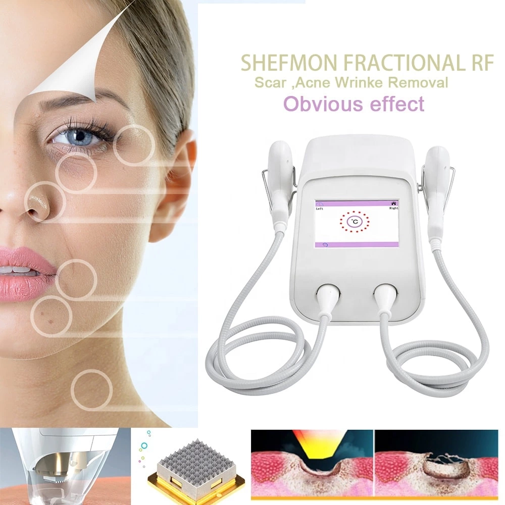 Tixeler skin rejuvenation machine