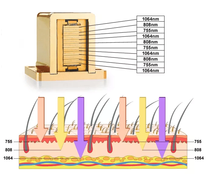 remov laser hair