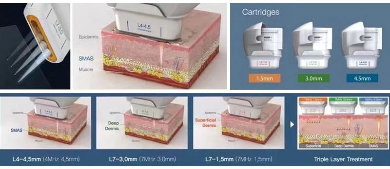 skin tightening device