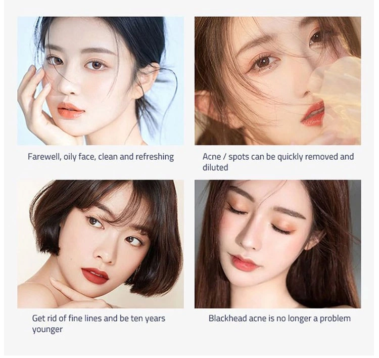 IPL Haarentfernungsmaschine Preis