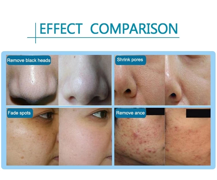 hydra beauty machine