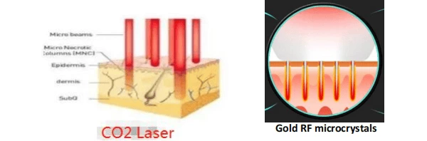 gold rf microcrystals