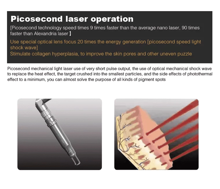 Pigmentation Removal Picosecond Laser Machine