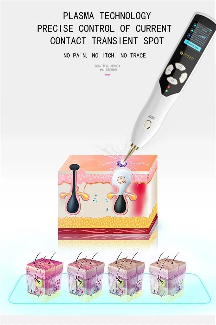 Mole Spot Sweeping Magic Pen Beauty Freckle Removing Spot Plasma Pen