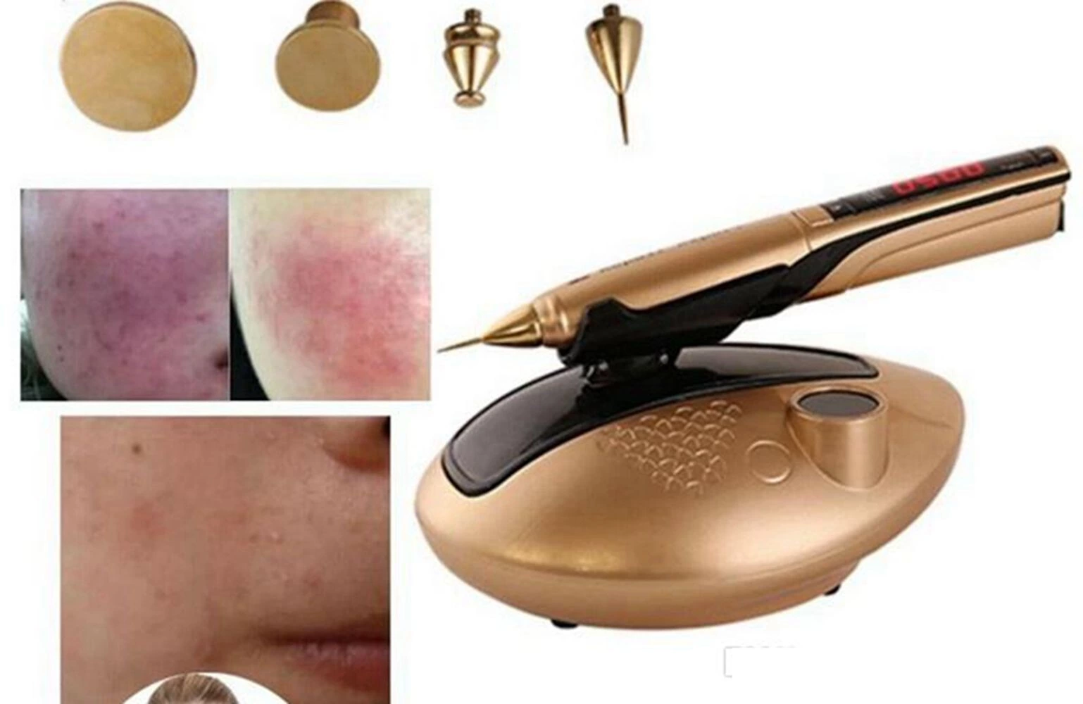 Multifunctional Jet Plasma Clean Skin Improve Fine Lines Anti Wrinkle