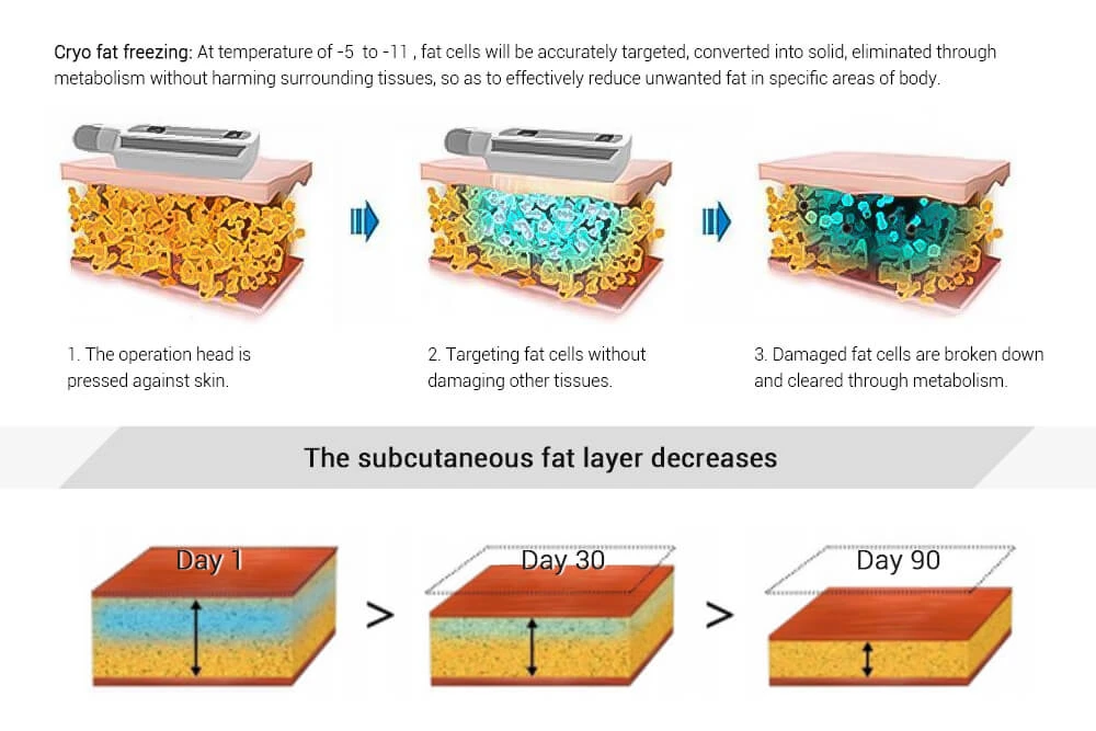 Portable cryo fat freezing machine