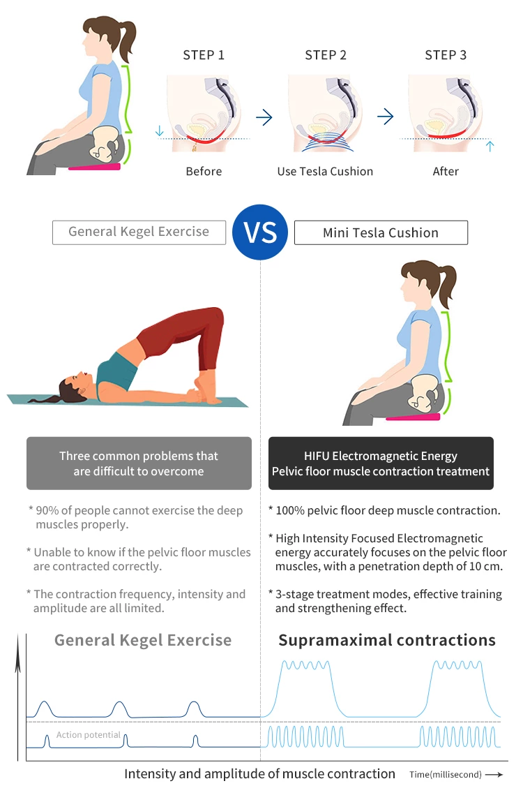 rf fat burning stimulator vestline mermaid line body sculpting butt muscles tightening machine