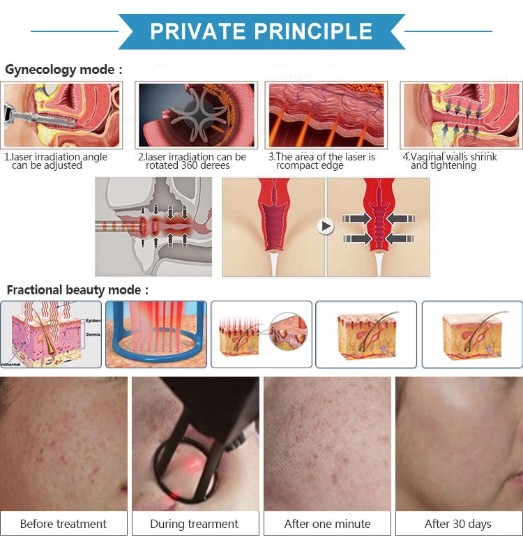 Co2 Fractional Laser Machine Wrinkle removal skin tightening